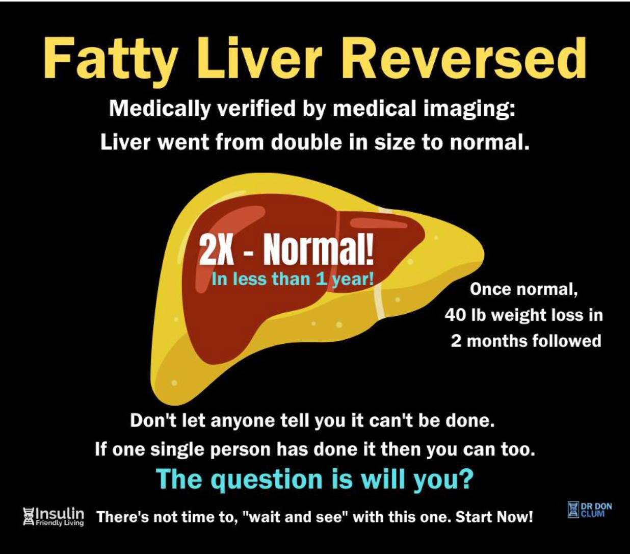 Fatty Liver Disease Reversed Dr Don Clum 