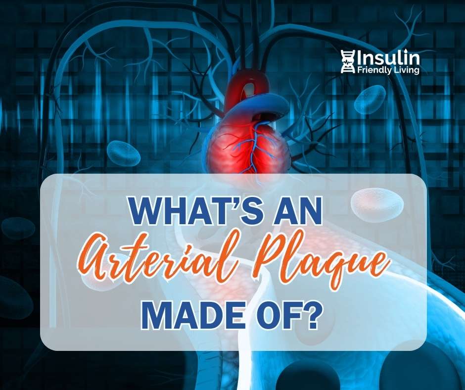 What Is An Arterial Plaque Made Of Exactly? Dr. Don Clum